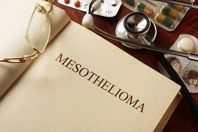 Mesothelioma Causes & Risk Factors